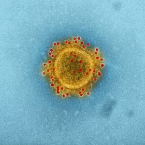 virus